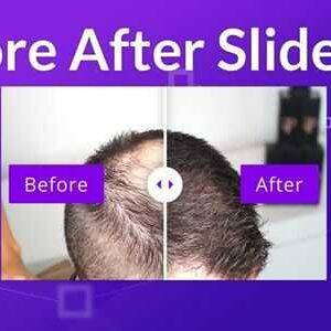 Divi Sensei Before After Slider GPL